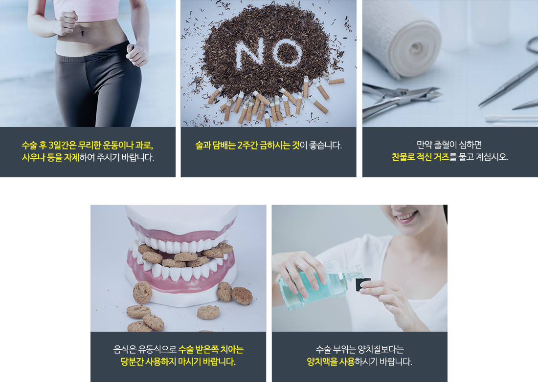 수면임플란트추천