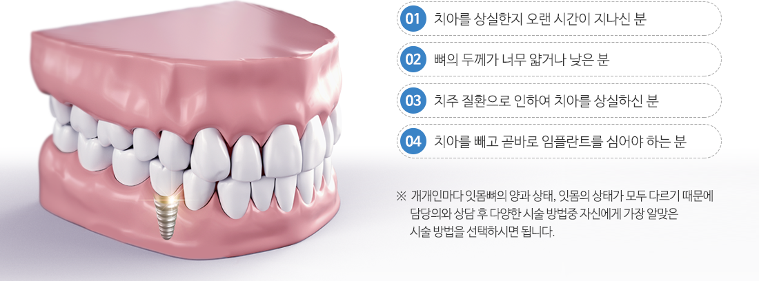 수면임플란트대상4