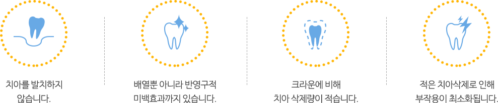 라미네이트