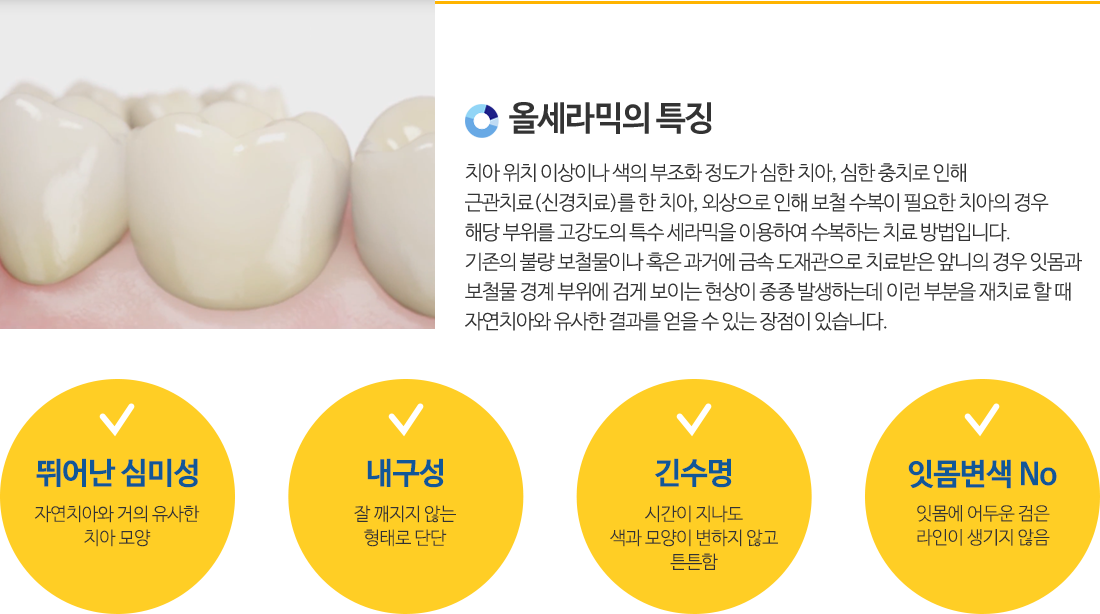 올세라믹/지르코니아특징