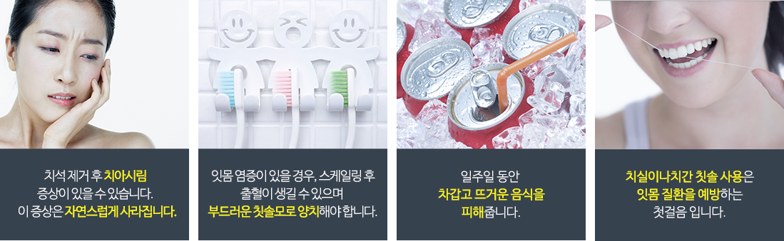 수면사랑니필요경우3가지