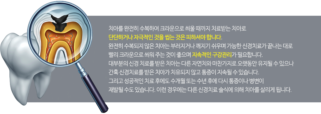 신경치료 후 주의사항내용