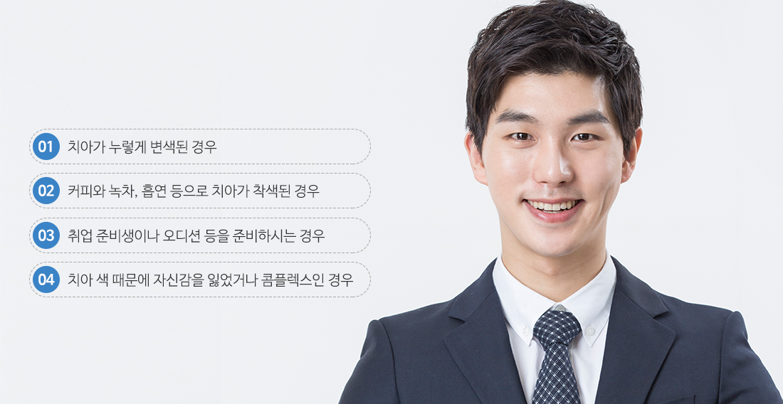 치아미백추천대상4가지