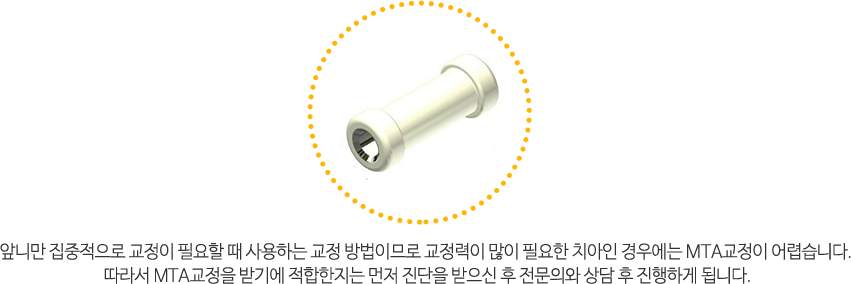 치아미백후주의사항4가지